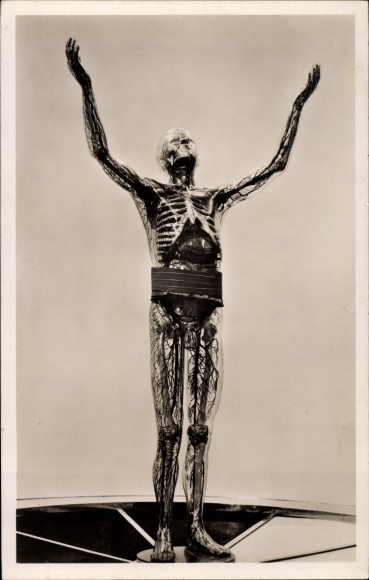 Postcard Exhibition The Miracle of Life, Berlin 1935, The Glass Man