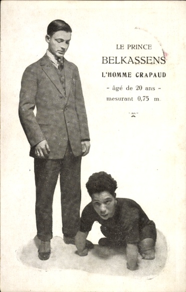 CPA Prince Balkassens, Homme Crapaud