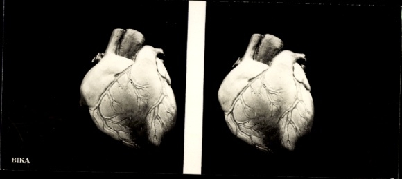 Stereo photo human heart, BIKA
