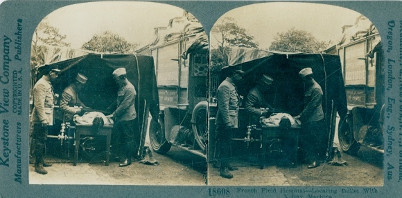 Stereo photo French Field Hospital, locating bullet with X Ray machine