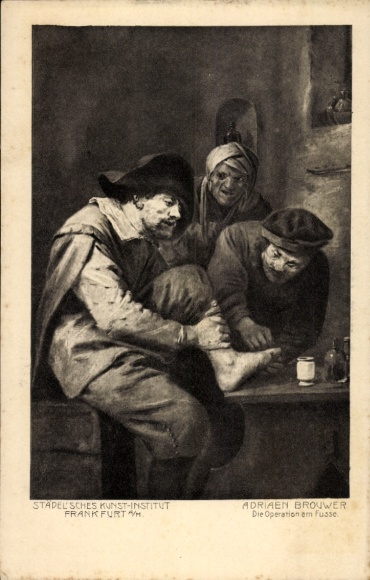 Künstler Ak Adriaen Brouwer, Die Operation am Fusse