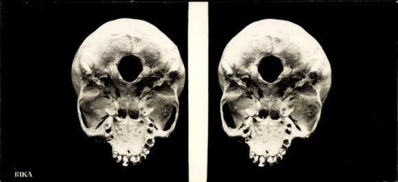 Stereo photo of human skull, view from below, BIKA