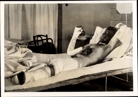 Fot. H. Hoffmann, Ofiary poparzenia, wybuch trującego gazu przed miastem Jasło, gaz żółtego krzyża, 1939