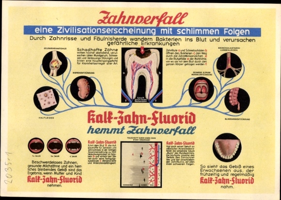 Timetable Eidran toothpaste, tooth fluoride, tooth decay, lime tooth fluoride inhibits tooth decay circa 1960