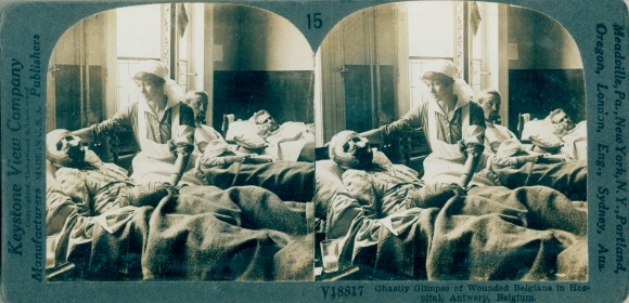 Stereo photo The Horror of War, ghastly glimpse of wounded, I WK