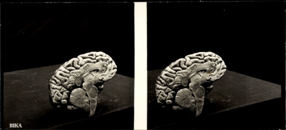 Stereo photo model of a human brain, BIKA
