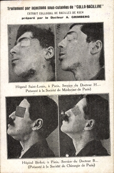 Ak Collo Bacillin, Voor de behandeling van uitwendige tuberculose, dokter A. Grimberg